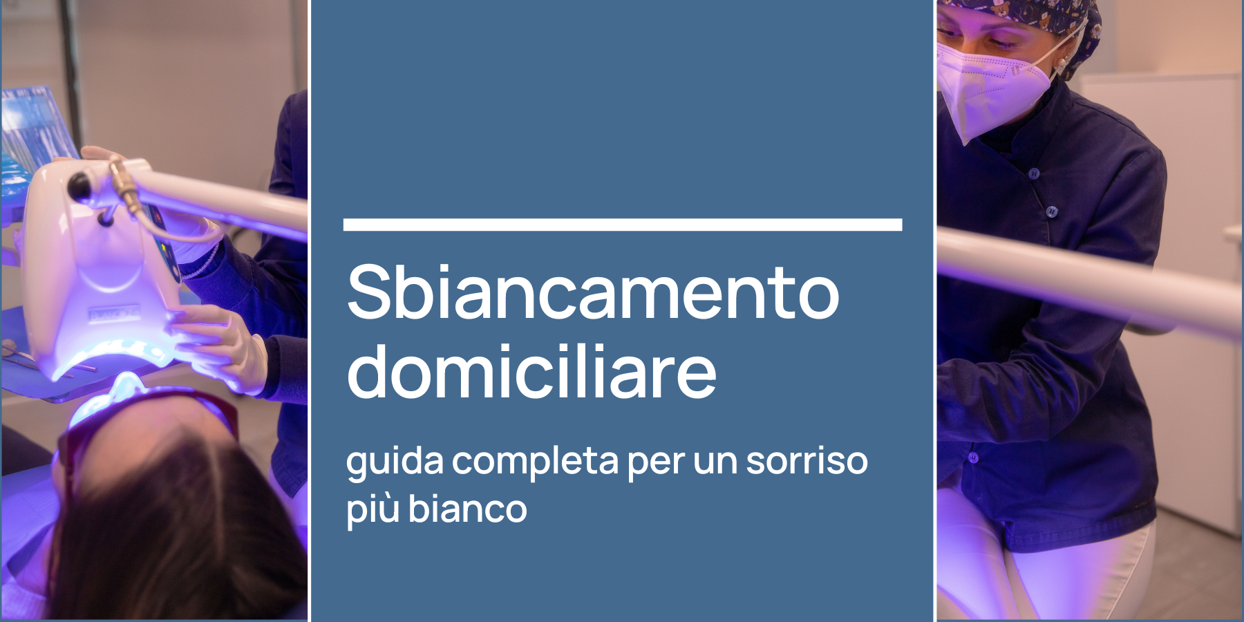 sbiancamento domiciliare