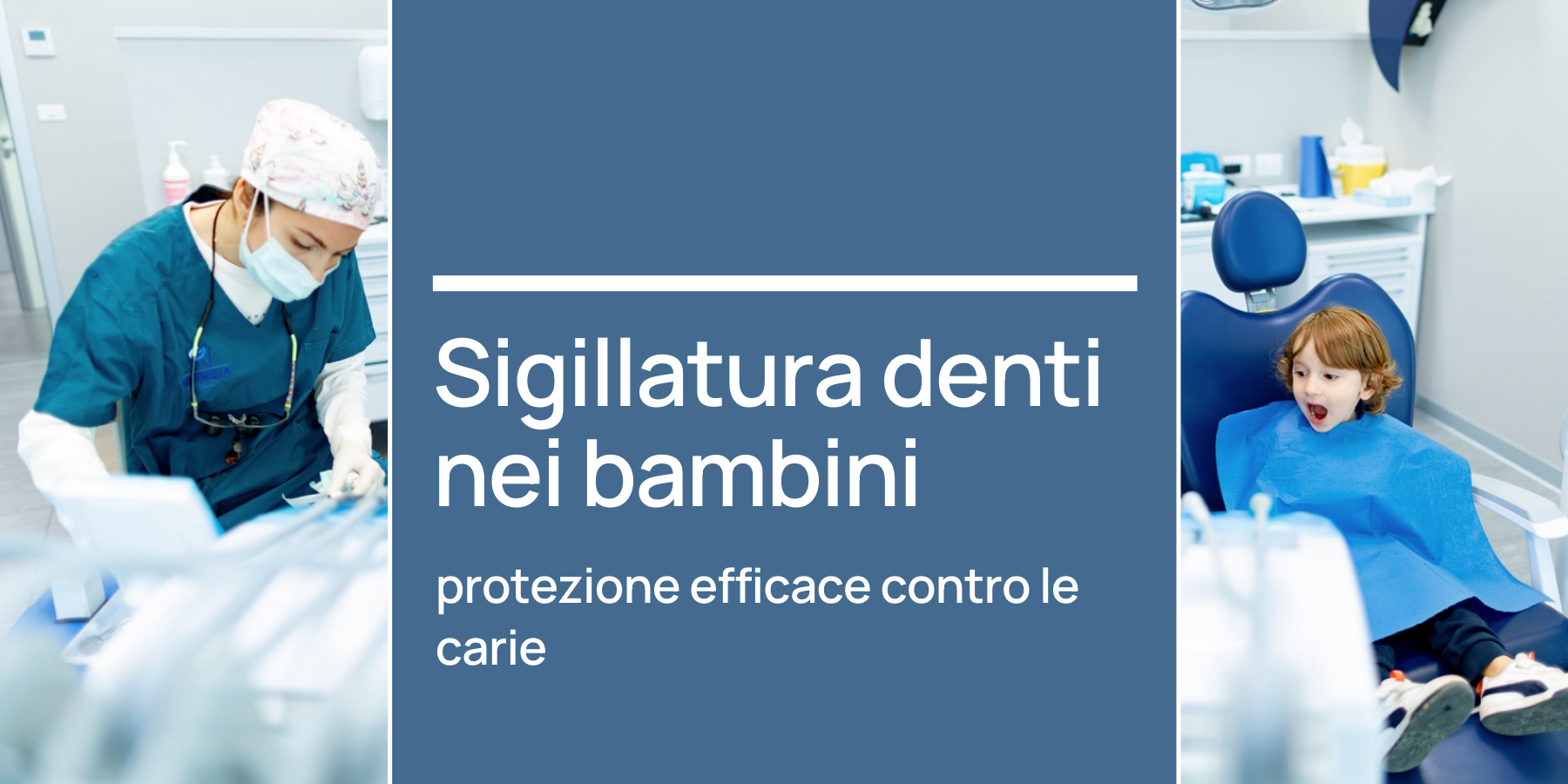 Sigillatura denti bambini