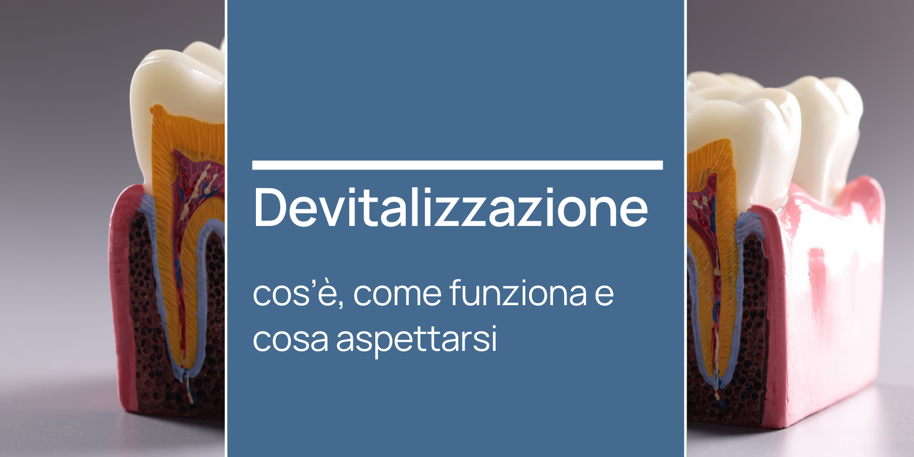 Devitalizzazione dente